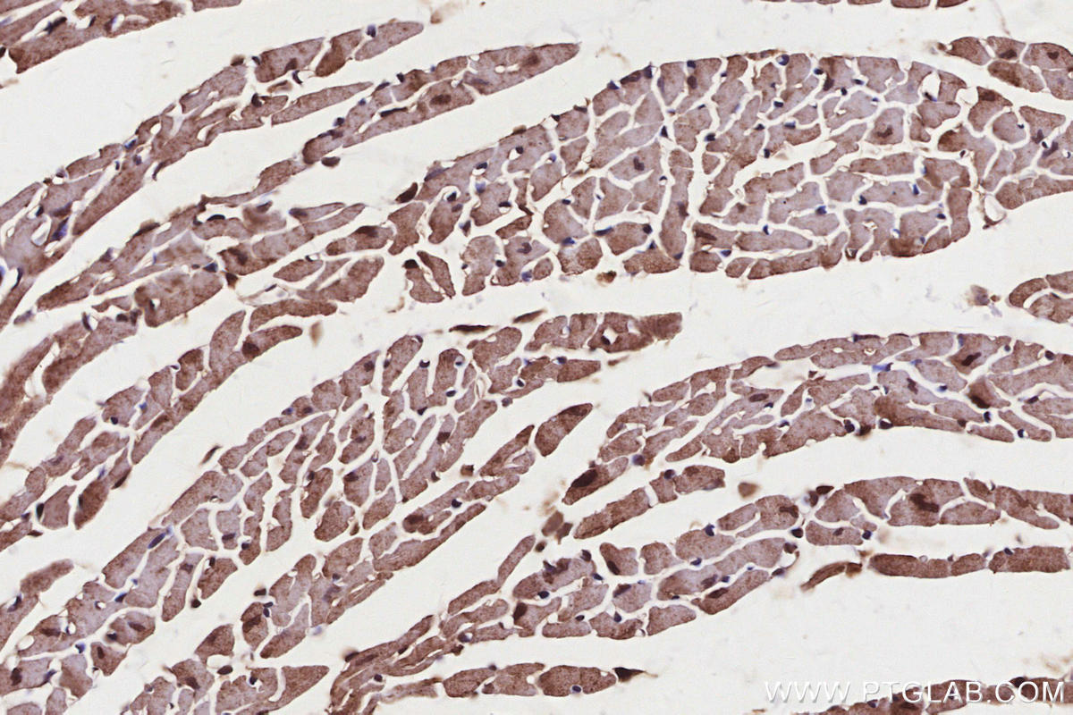 Immunohistochemistry (IHC) staining of mouse heart tissue using PIP5K1A Polyclonal antibody (15713-1-AP)