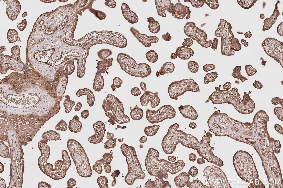 Immunohistochemistry (IHC) staining of human placenta tissue using PIP5K1A Polyclonal antibody (15713-1-AP)