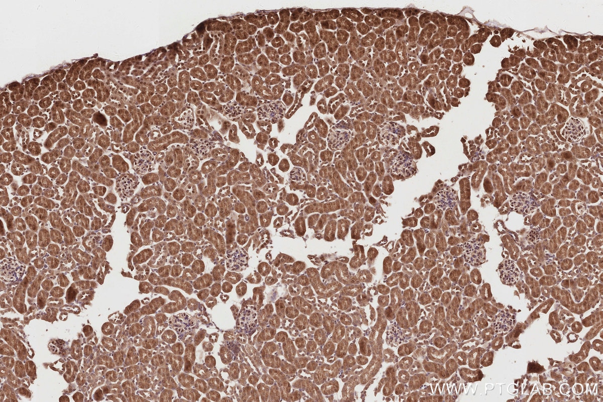 Immunohistochemistry (IHC) staining of mouse kidney tissue using PIP5K1A Polyclonal antibody (15713-1-AP)