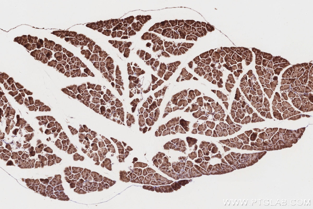 Immunohistochemistry (IHC) staining of mouse pancreas tissue using PIP5K1A Polyclonal antibody (15713-1-AP)