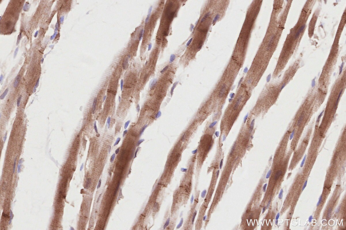 Immunohistochemistry (IHC) staining of rat heart tissue using PIP5K1A Polyclonal antibody (15713-1-AP)