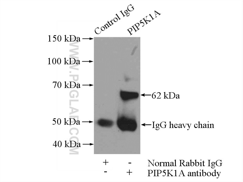 Immunoprecipitation (IP) experiment of mouse heart tissue using PIP5K1A Polyclonal antibody (15713-1-AP)