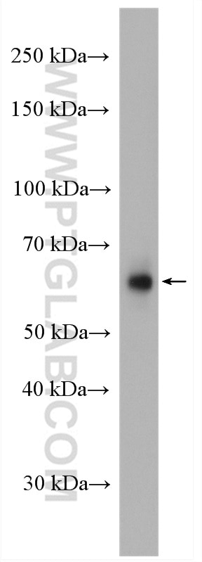 Western Blot (WB) analysis of HeLa cells using PIP5K1A Polyclonal antibody (15713-1-AP)