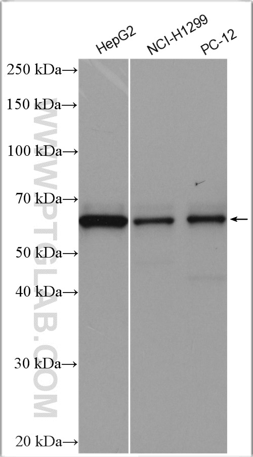 Western Blot (WB) analysis of various lysates using PIP5K1A Polyclonal antibody (15713-1-AP)
