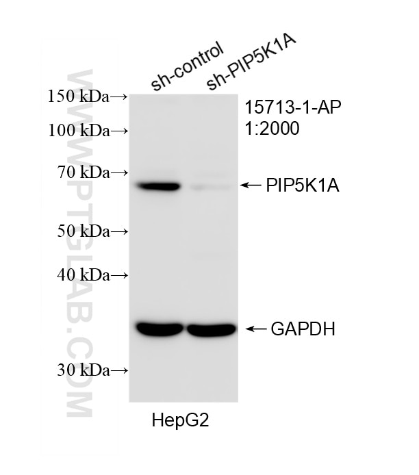 Western Blot (WB) analysis of HepG2 cells using PIP5K1A Polyclonal antibody (15713-1-AP)