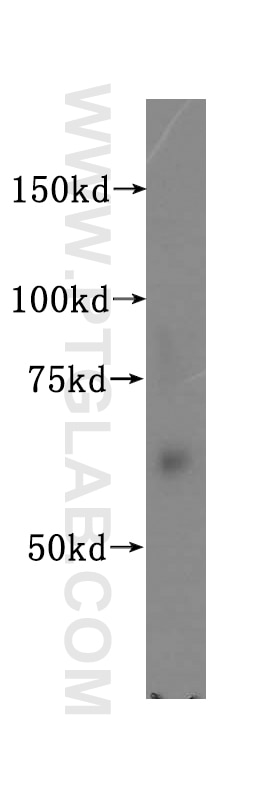 Western Blot (WB) analysis of human liver tissue using PIP5K1A Polyclonal antibody (15713-1-AP)