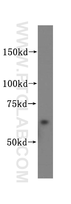 Western Blot (WB) analysis of human heart tissue using PIP5K1A Polyclonal antibody (15713-1-AP)