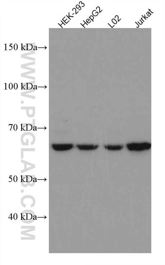 Western Blot (WB) analysis of various lysates using PIP5K1A Monoclonal antibody (67483-1-Ig)