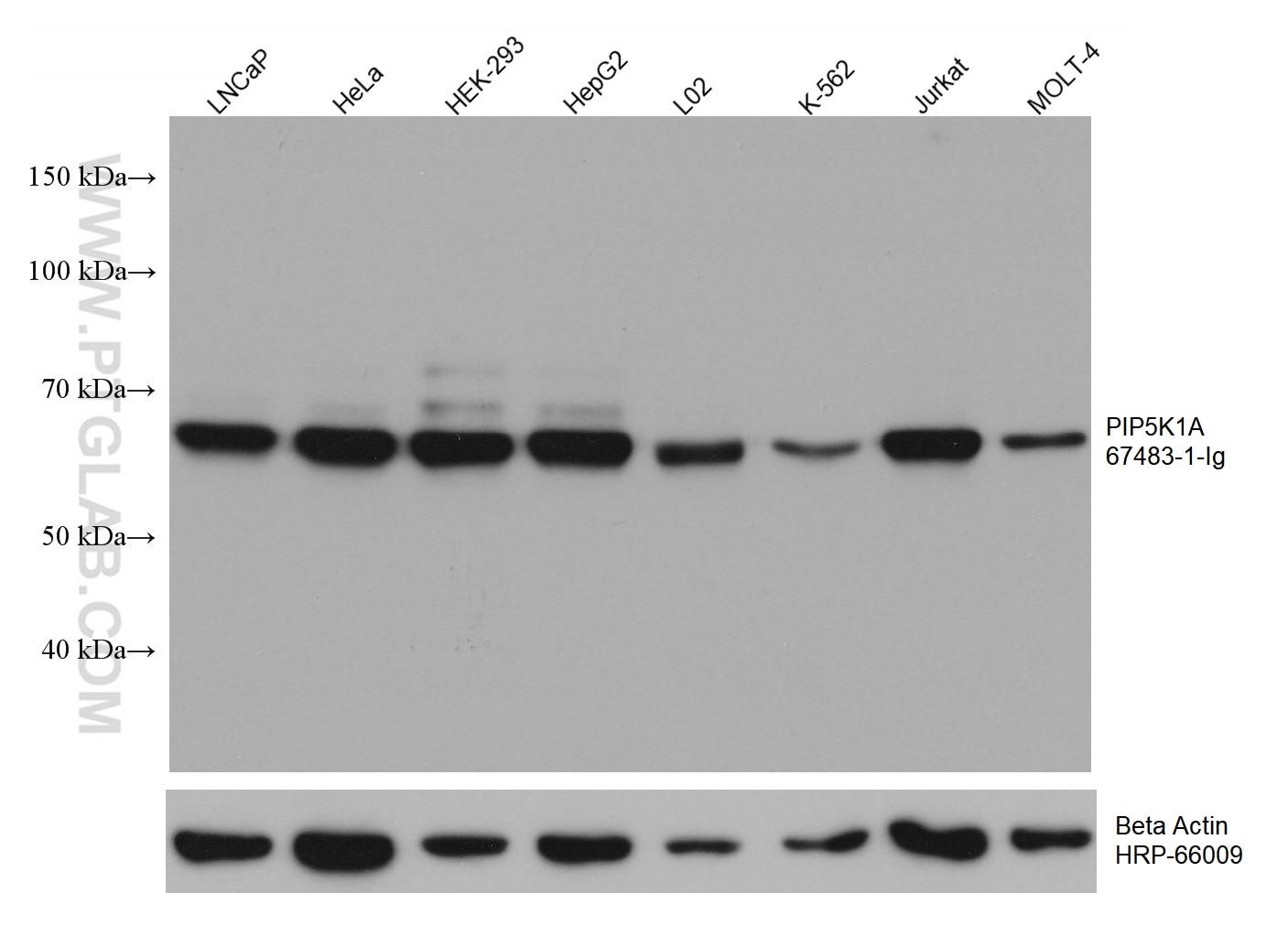 Western Blot (WB) analysis of various lysates using PIP5K1A Monoclonal antibody (67483-1-Ig)