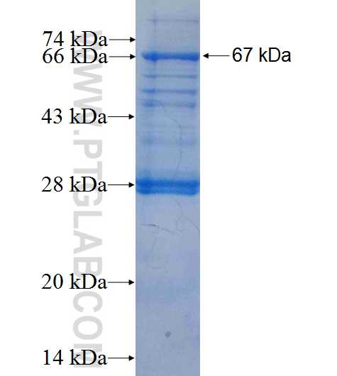PIP5K1A fusion protein Ag8340 SDS-PAGE