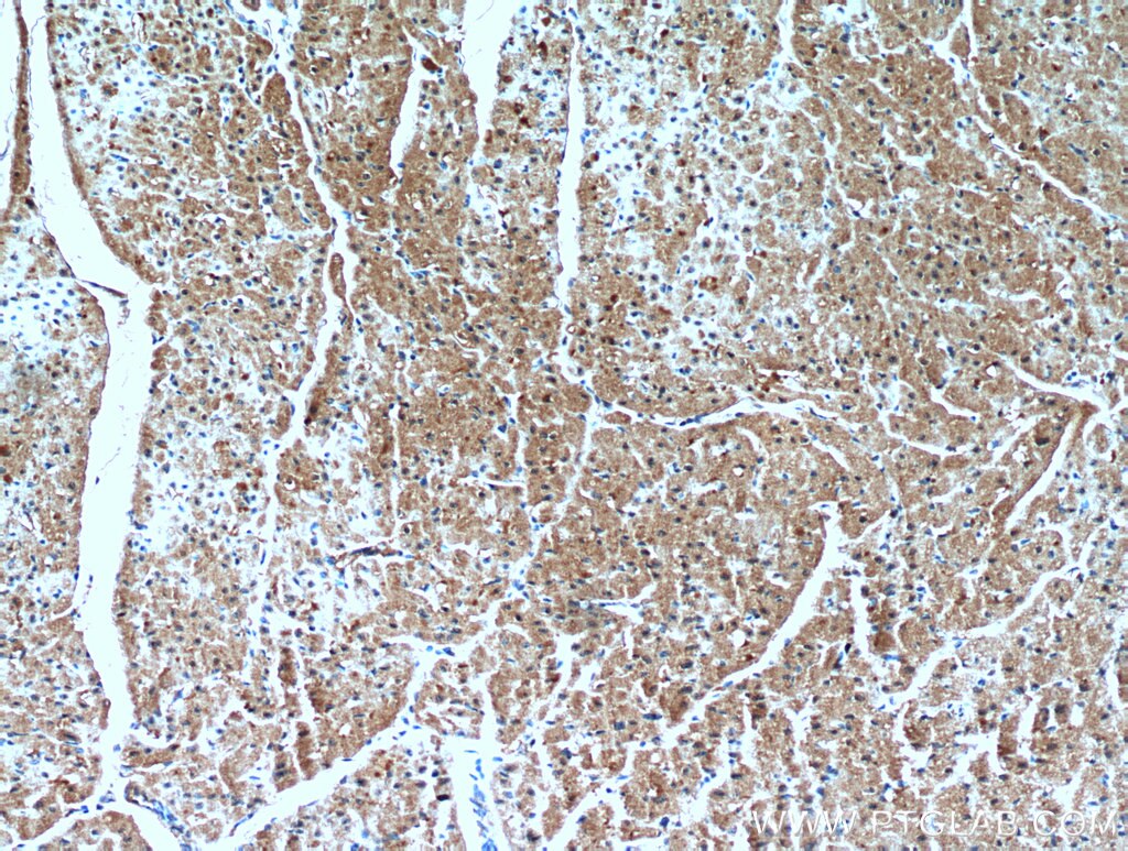 Immunohistochemistry (IHC) staining of human heart tissue using PIP5K1B Polyclonal antibody (12541-1-AP)