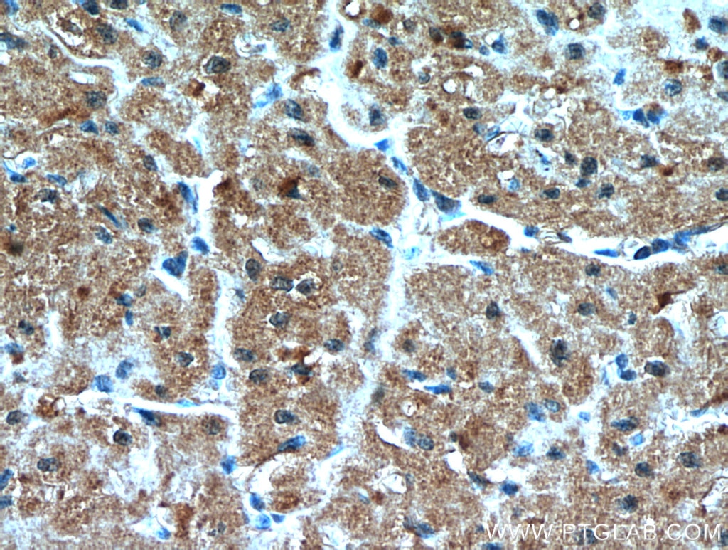 Immunohistochemistry (IHC) staining of human heart tissue using PIP5K1B Polyclonal antibody (12541-1-AP)