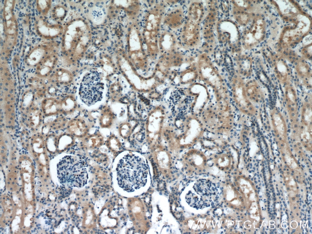 Immunohistochemistry (IHC) staining of human kidney tissue using PIP5K1B Polyclonal antibody (12541-1-AP)