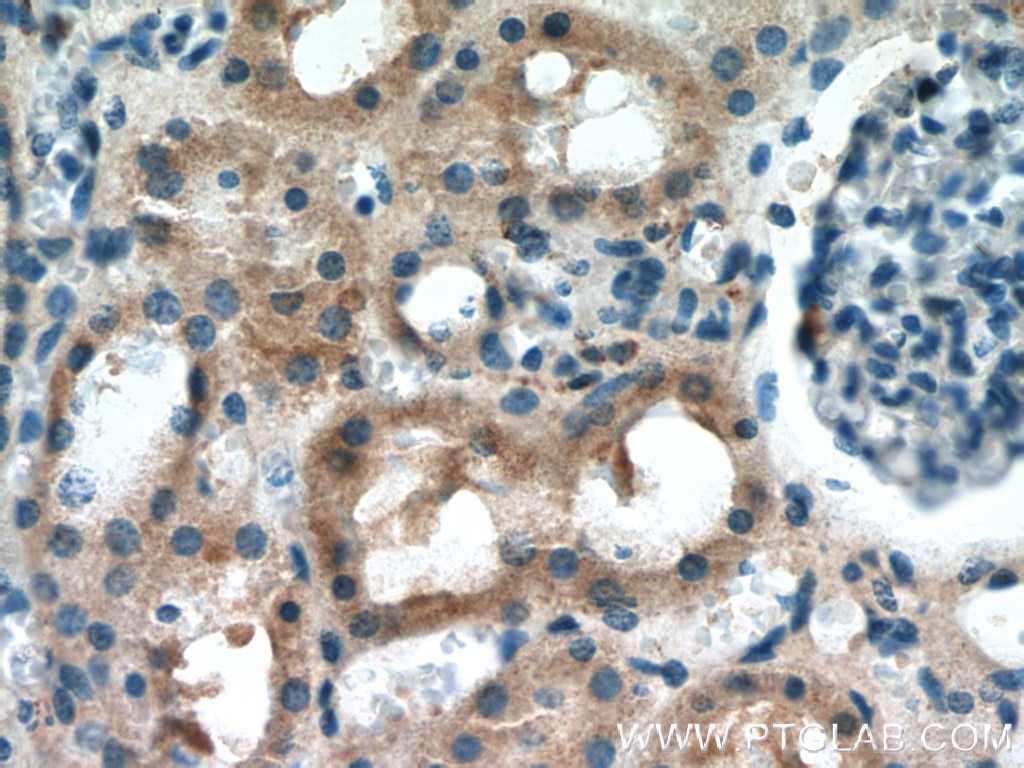 Immunohistochemistry (IHC) staining of human kidney tissue using PIP5K1B Polyclonal antibody (12541-1-AP)