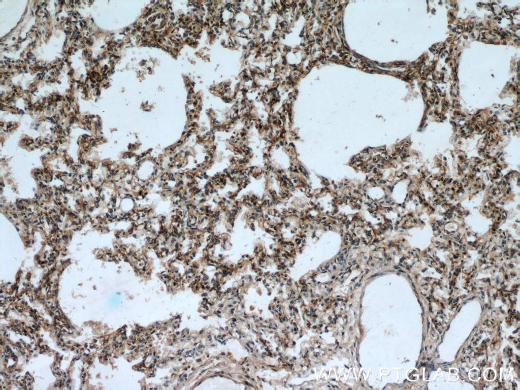 Immunohistochemistry (IHC) staining of human lung tissue using PIP5K1B Polyclonal antibody (12541-1-AP)