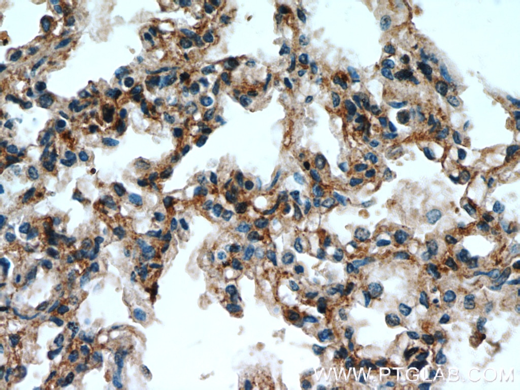 IHC staining of human lung using 12541-1-AP
