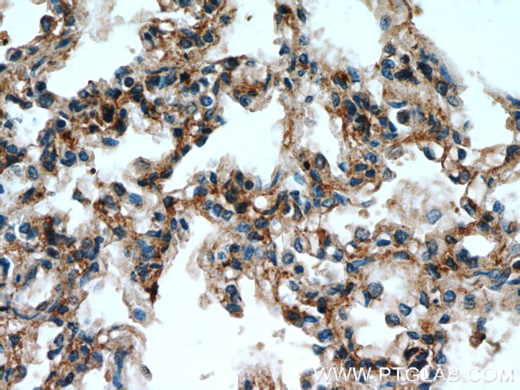 Immunohistochemistry (IHC) staining of human lung tissue using PIP5K1B Polyclonal antibody (12541-1-AP)