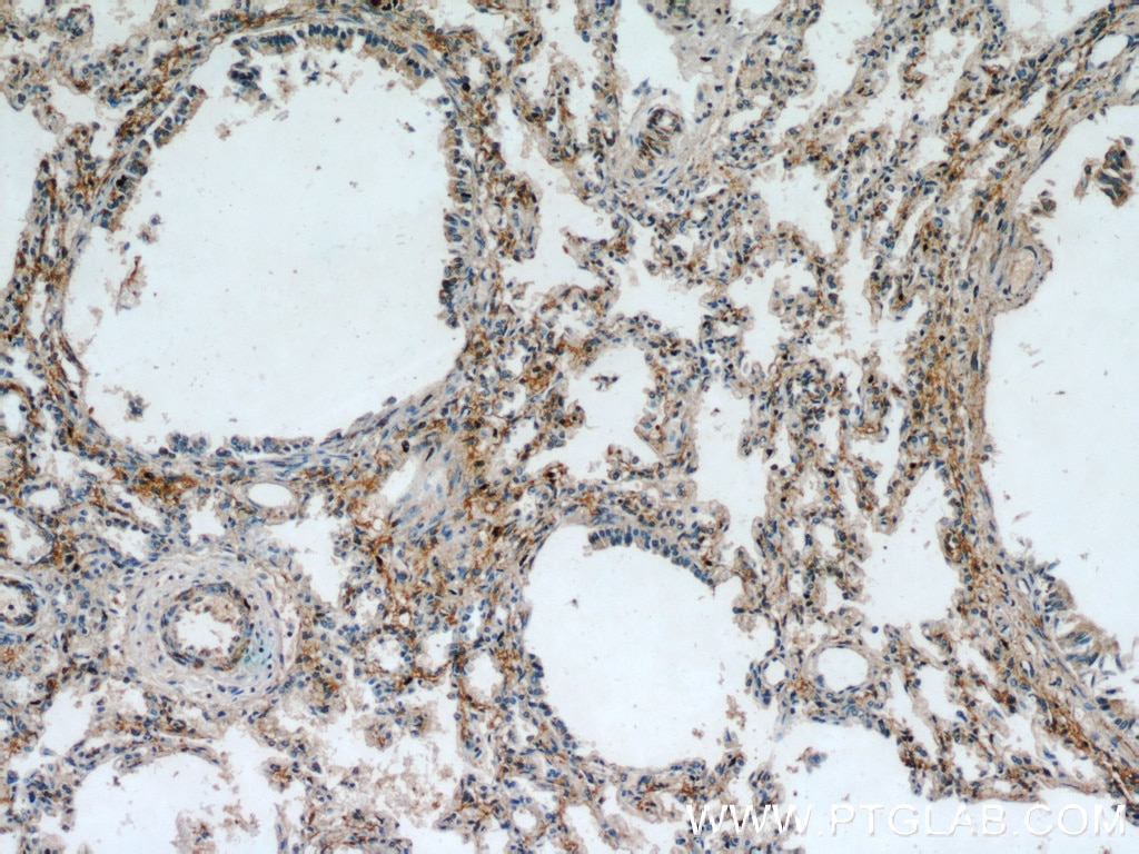 Immunohistochemistry (IHC) staining of human lung tissue using PIP5K1B Polyclonal antibody (12541-1-AP)