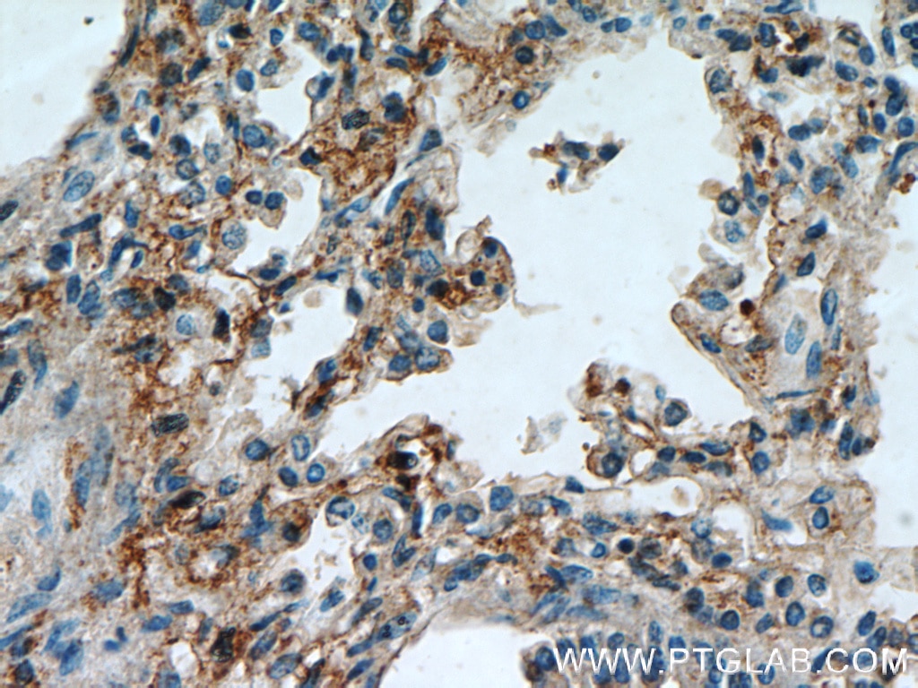 Immunohistochemistry (IHC) staining of human lung tissue using PIP5K1B Polyclonal antibody (12541-1-AP)