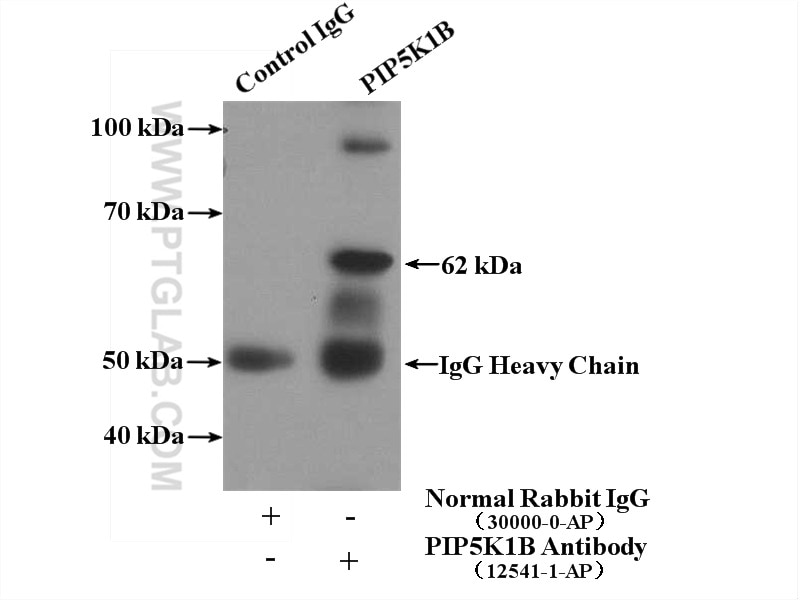 Immunoprecipitation (IP) experiment of mouse testis tissue using PIP5K1B Polyclonal antibody (12541-1-AP)