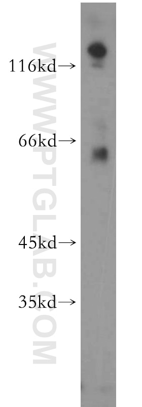 Western Blot (WB) analysis of human brain tissue using PIP5K1B Polyclonal antibody (12541-1-AP)