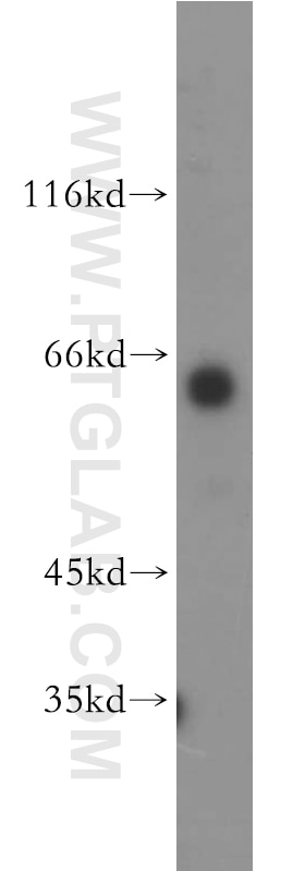 Western Blot (WB) analysis of human testis tissue using PIP5K1B Polyclonal antibody (12541-1-AP)
