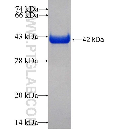 PIP5K1B fusion protein Ag3261 SDS-PAGE