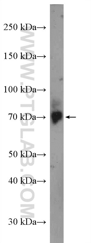 Western Blot (WB) analysis of A549 cells using PIP5K1C Polyclonal antibody (27640-1-AP)