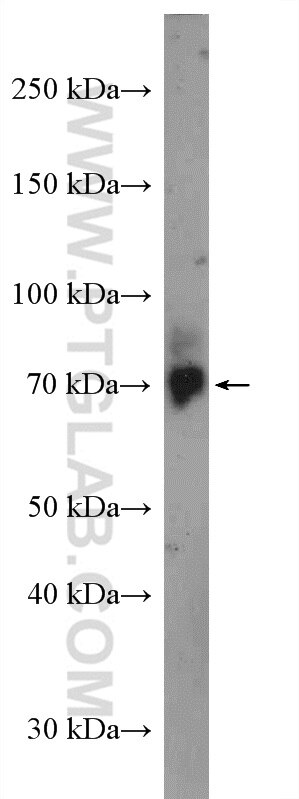 WB analysis of A549 using 27640-1-AP