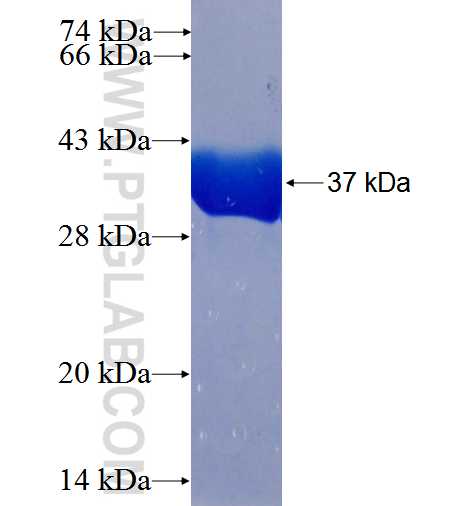 PIP5K1C fusion protein Ag26525 SDS-PAGE