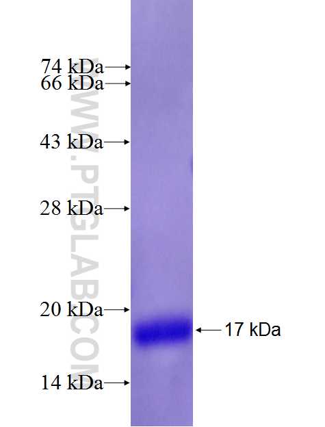 PIP5K1C fusion protein Ag26676 SDS-PAGE