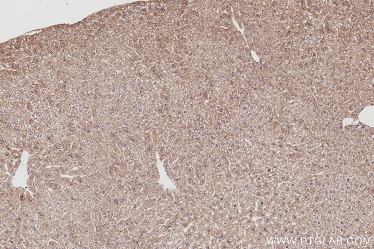 Immunohistochemistry (IHC) staining of mouse liver tissue using PIP5K3 Polyclonal antibody (13361-1-AP)