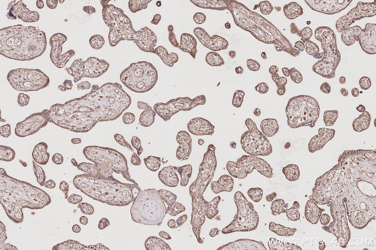 Immunohistochemistry (IHC) staining of human placenta tissue using PIP5K3 Polyclonal antibody (13361-1-AP)