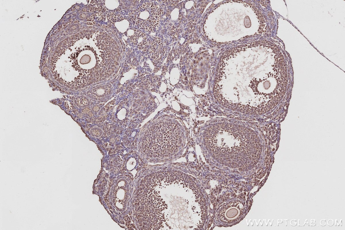 Immunohistochemistry (IHC) staining of mouse ovary tissue using PIP5K3 Polyclonal antibody (13361-1-AP)