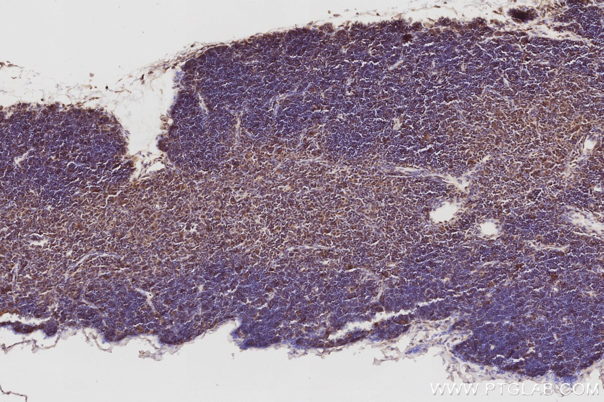 Immunohistochemistry (IHC) staining of mouse thymus tissue using PIP5K3 Polyclonal antibody (13361-1-AP)