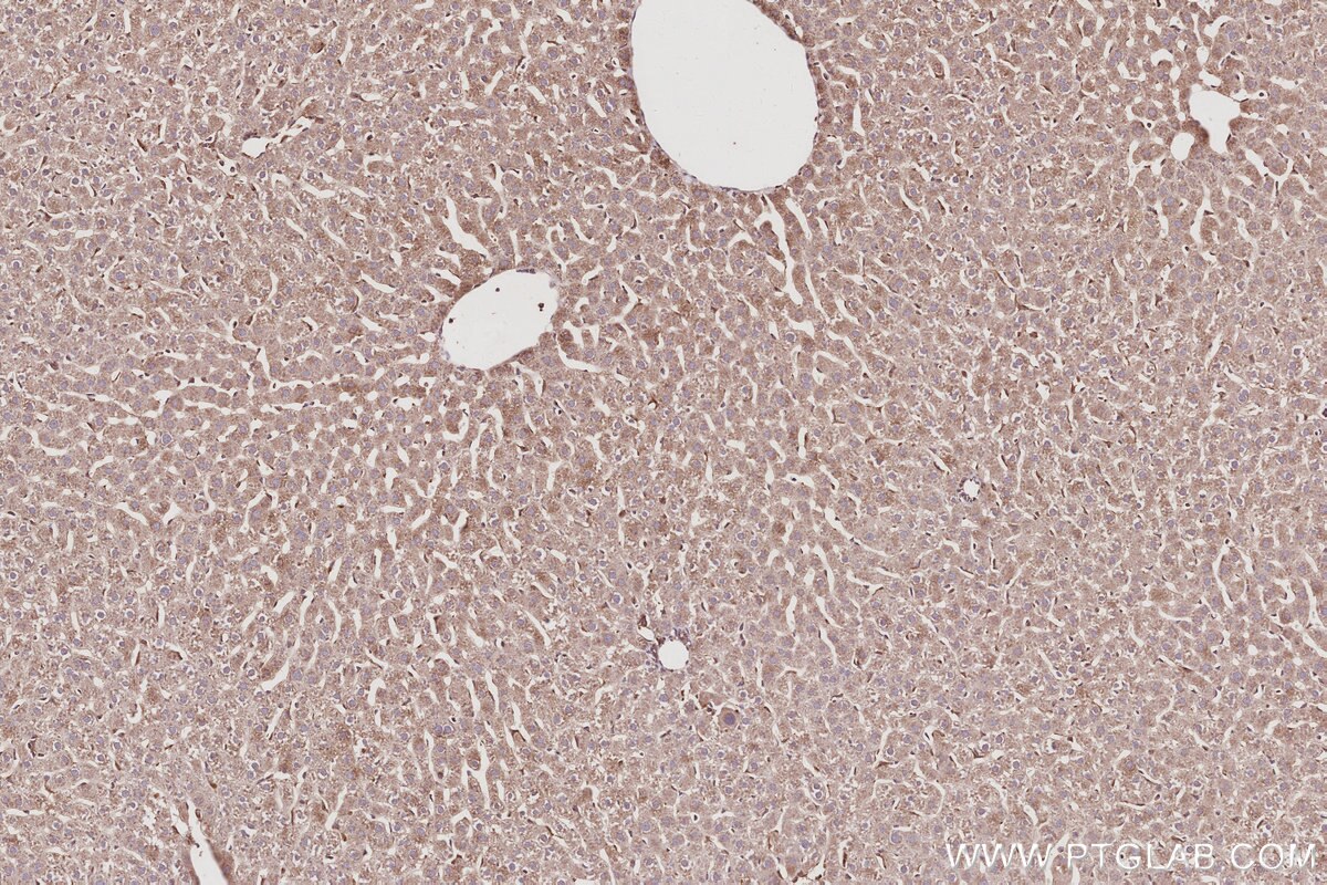 Immunohistochemistry (IHC) staining of rat liver tissue using PIP5K3 Polyclonal antibody (13361-1-AP)