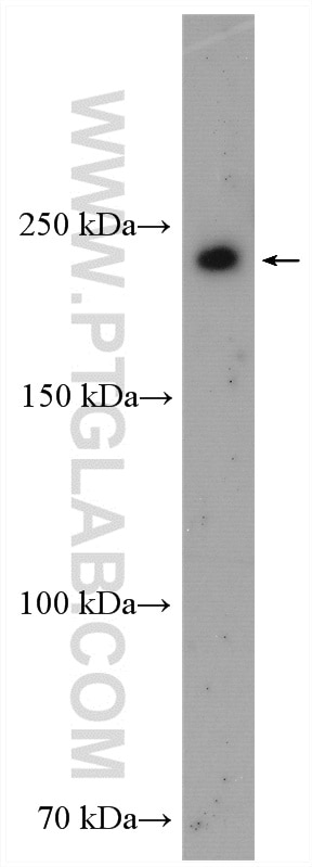Western Blot (WB) analysis of mouse lung tissue using PIP5K3 Polyclonal antibody (13361-1-AP)