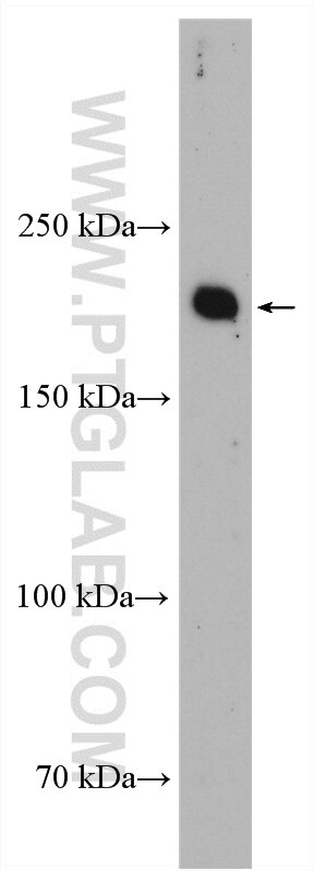 Western Blot (WB) analysis of mouse lung tissue using PIP5K3 Polyclonal antibody (13361-1-AP)