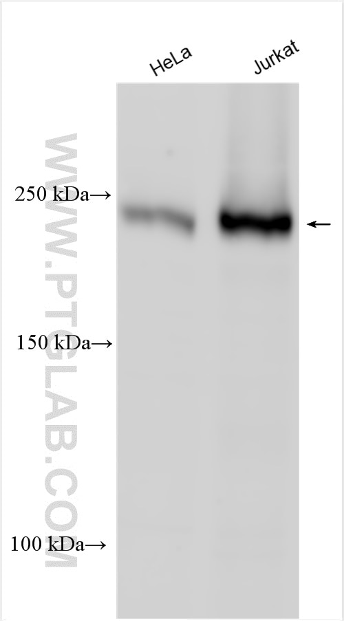 Western Blot (WB) analysis of various lysates using PIP5K3 Polyclonal antibody (13361-1-AP)