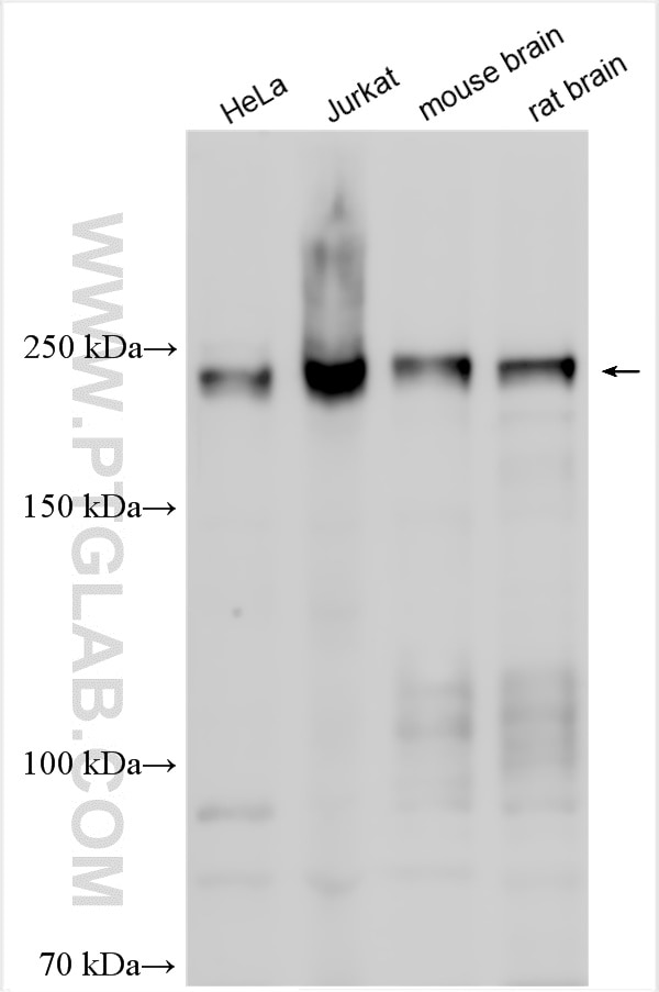 Western Blot (WB) analysis of various lysates using PIP5K3 Polyclonal antibody (13361-1-AP)