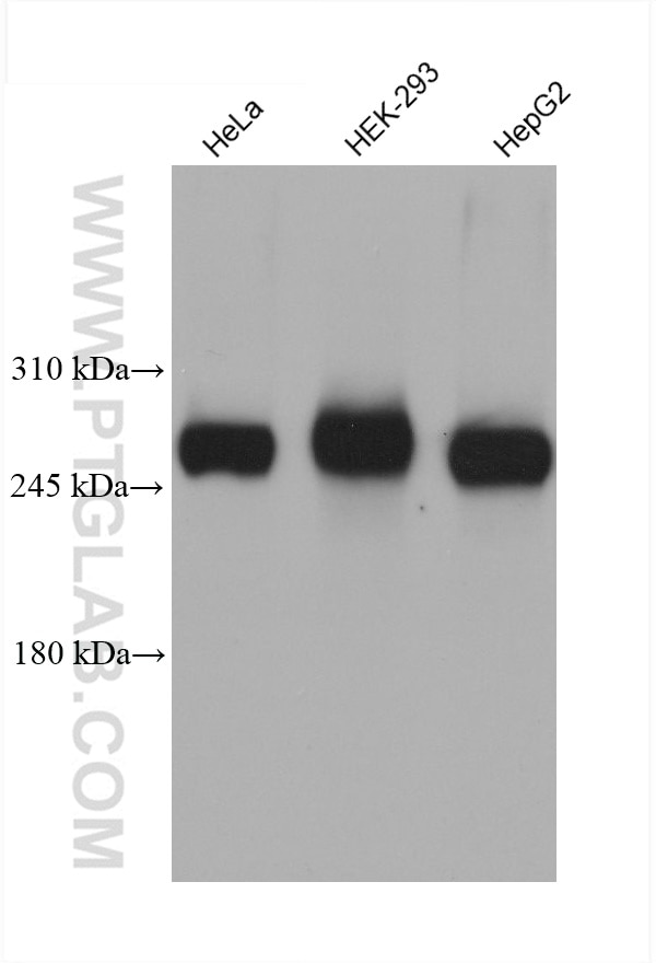 Western Blot (WB) analysis of various lysates using PIP5K3 Monoclonal antibody (68571-1-Ig)
