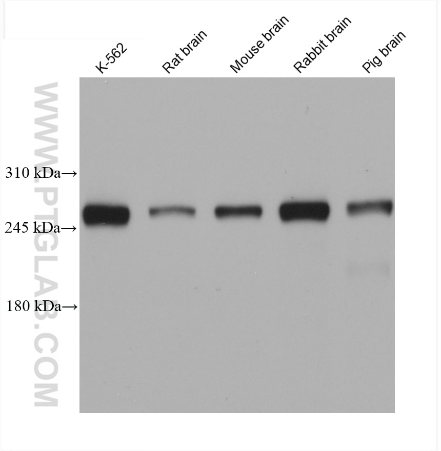 Western Blot (WB) analysis of various lysates using PIP5K3 Monoclonal antibody (68571-1-Ig)