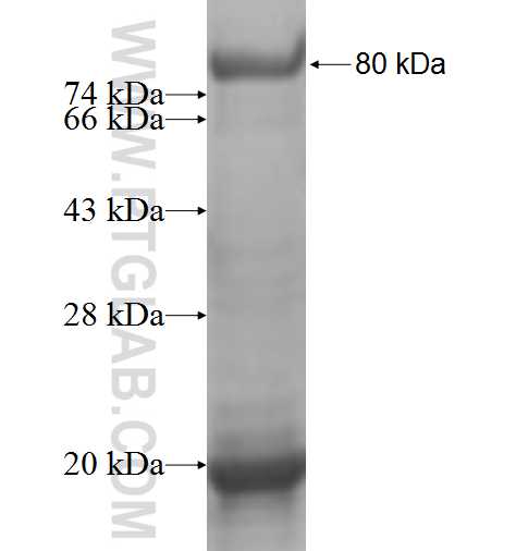 PIP5K3 fusion protein Ag4177 SDS-PAGE