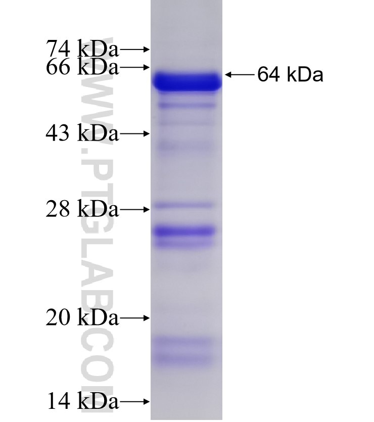 PIP5K3 fusion protein Ag4366 SDS-PAGE