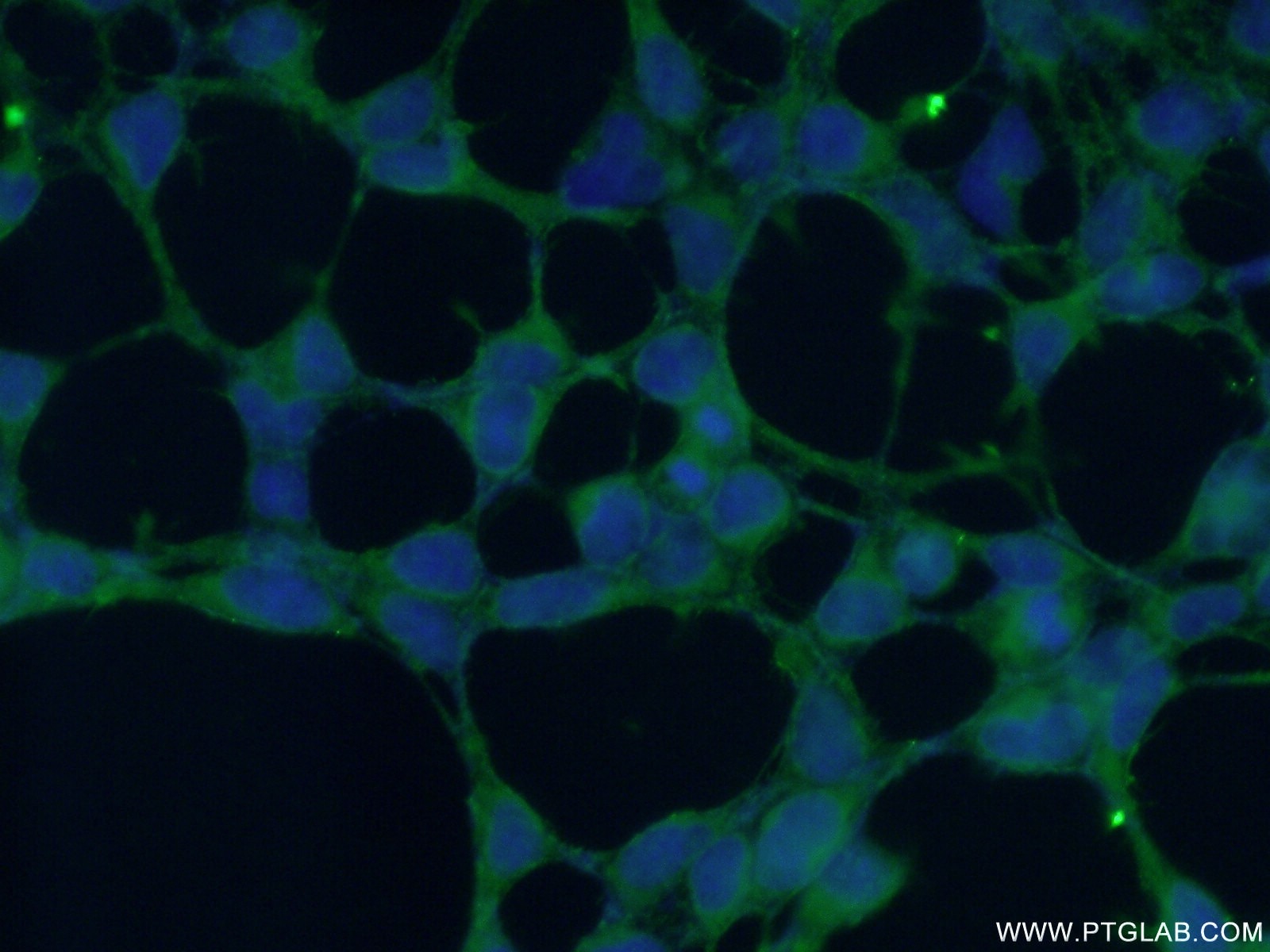 Immunofluorescence (IF) / fluorescent staining of HEK-293 cells using PIP5KL1 Polyclonal antibody (17547-1-AP)