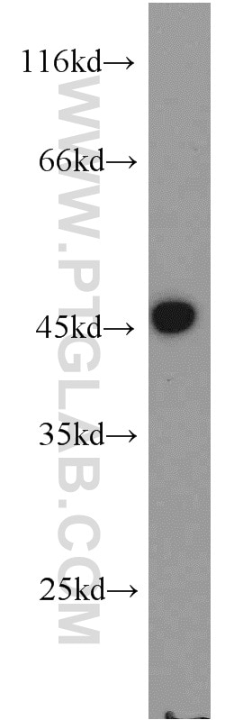 Western Blot (WB) analysis of HEK-293 cells using PIP5KL1 Polyclonal antibody (17547-1-AP)