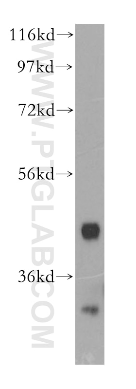 Western Blot (WB) analysis of human brain tissue using PIP5KL1 Polyclonal antibody (17547-1-AP)