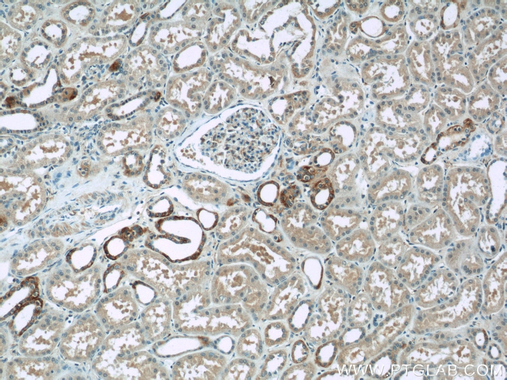 Immunohistochemistry (IHC) staining of human kidney tissue using PIPPIN Polyclonal antibody (25013-1-AP)
