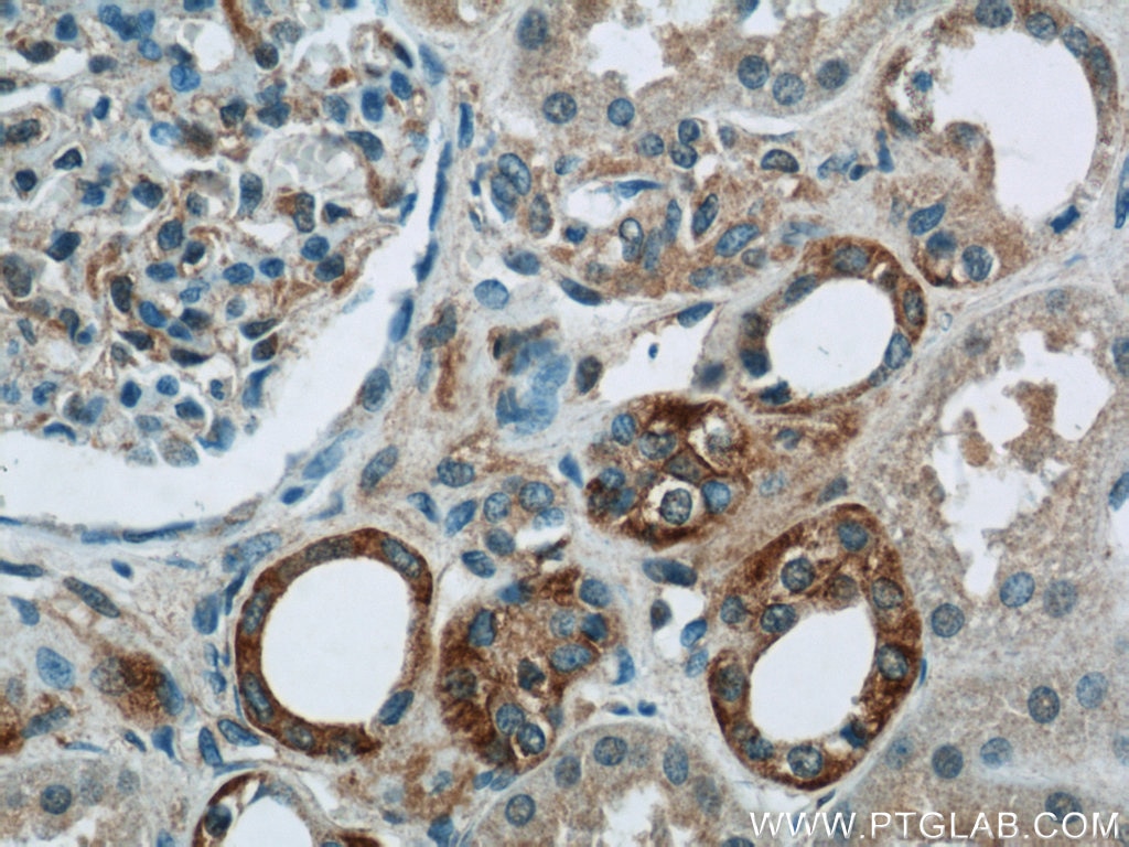 Immunohistochemistry (IHC) staining of human kidney tissue using PIPPIN Polyclonal antibody (25013-1-AP)