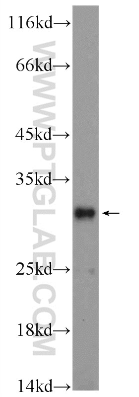 Western Blot (WB) analysis of mouse brain tissue using PIPPIN Polyclonal antibody (25013-1-AP)